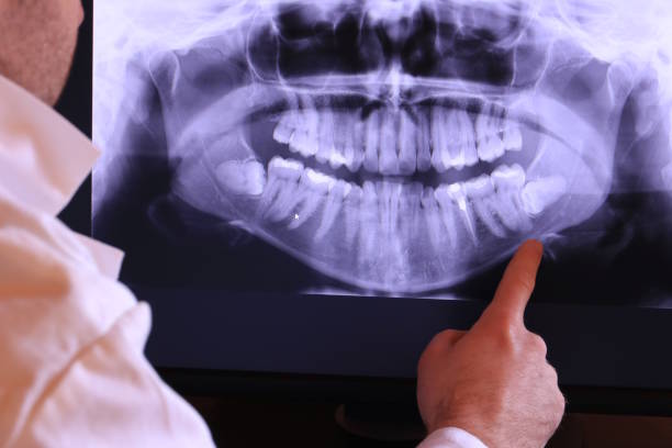 Best Weekend Emergency Dentist in Centerport, NY